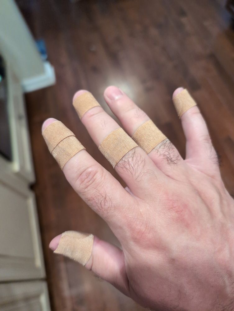 My right hand with 7 bandages