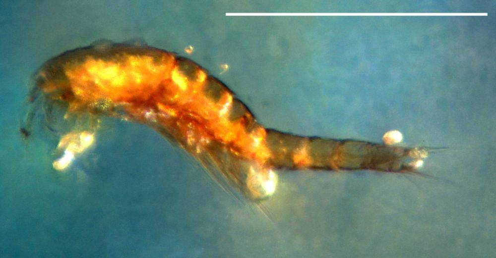 Copepod: Ectinosomatidae (IHNFG–4899/Cop1); A1 = antennule, A2 enp = antennary exopod, A2 enp = antennary endopod, GDS = genital double-somite, AS = anal somite. Scale bar 200 μm. Photo from Francisco Vega