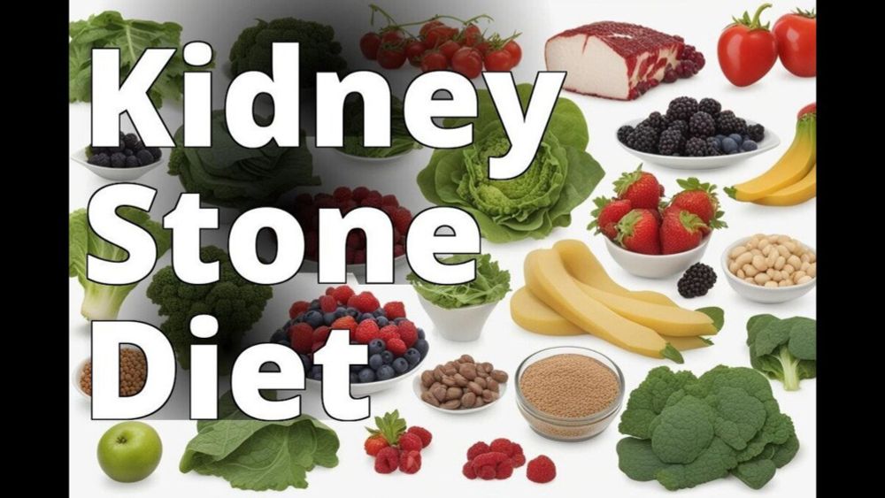 7 Day Kidney Stone Diet Chart