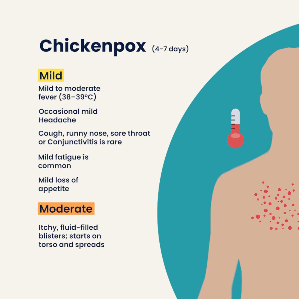 Tile with text that says: Chickenpox: Mild to moderate fever 38-39 degrees celcius. Occasional mild headache. Cough, runny nose, sore throat or conjunctivitis is rare. Mild fatigue is common. Mild loss of appetite. Itchy, fluid-filled blisters appear on torso and then spread. 