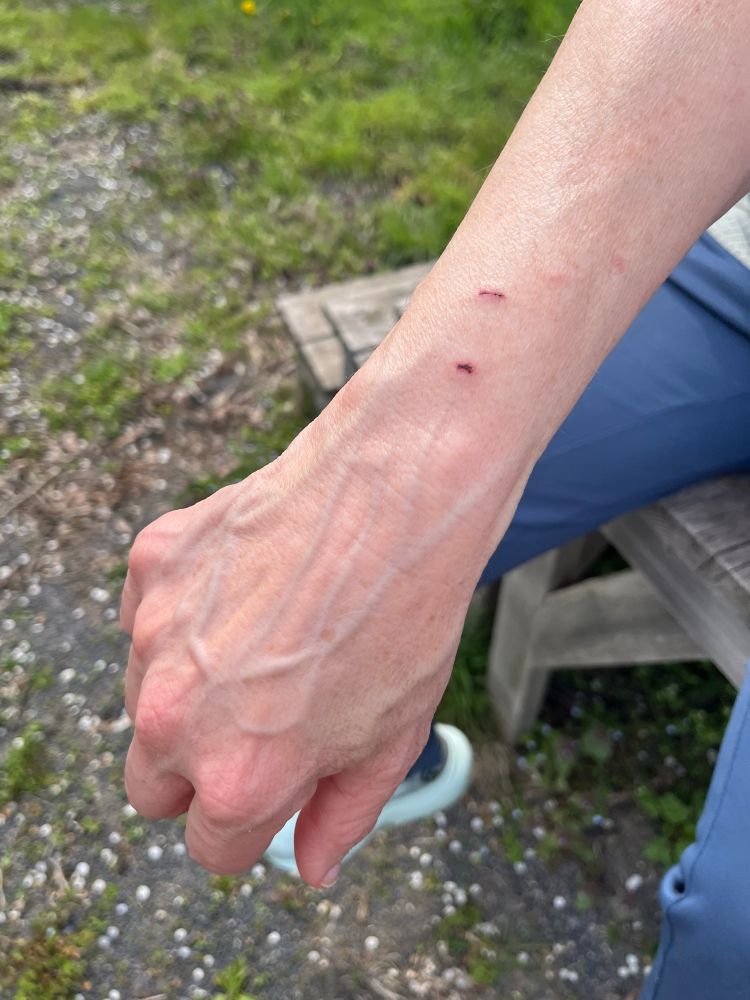 Marks on my wrist from where my cat bit me as I was trying to get her in her cat carrier 