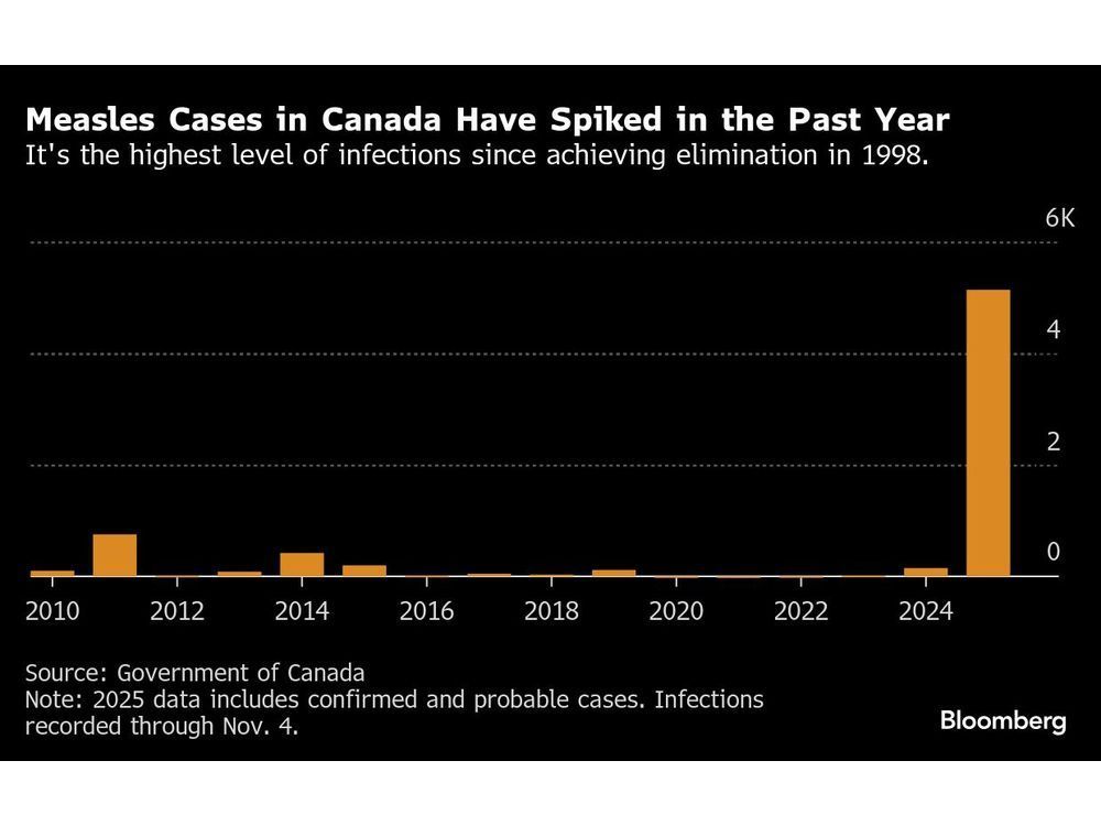 Canada Loses Measles-Free Status With Outbreak Passing One-Year Mark