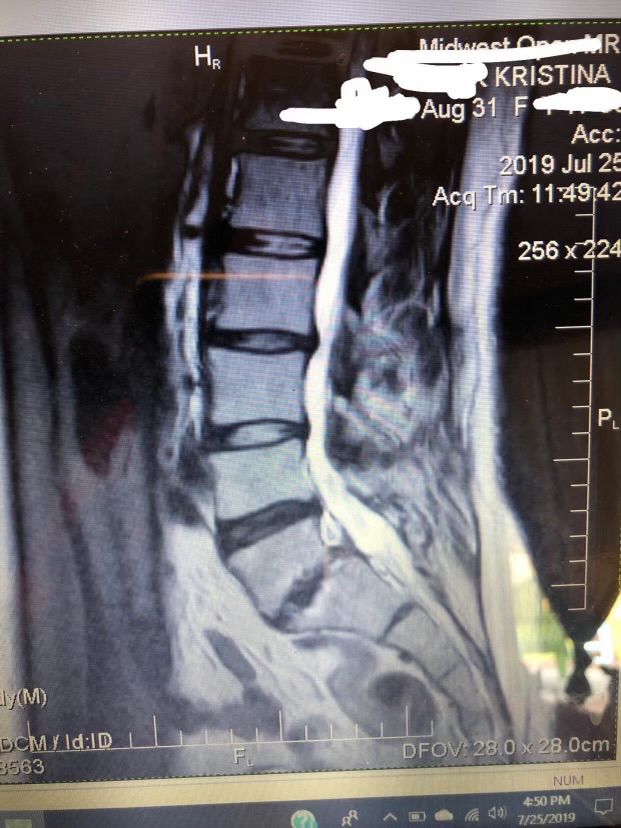 My MRI in 2019 