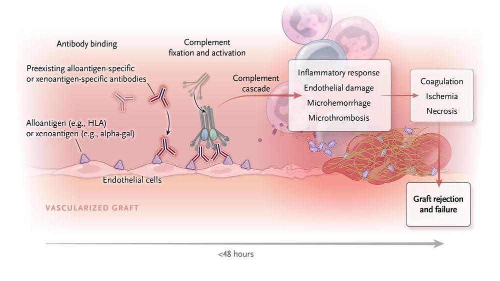Visual representation of "hyperimmune acute rejection"