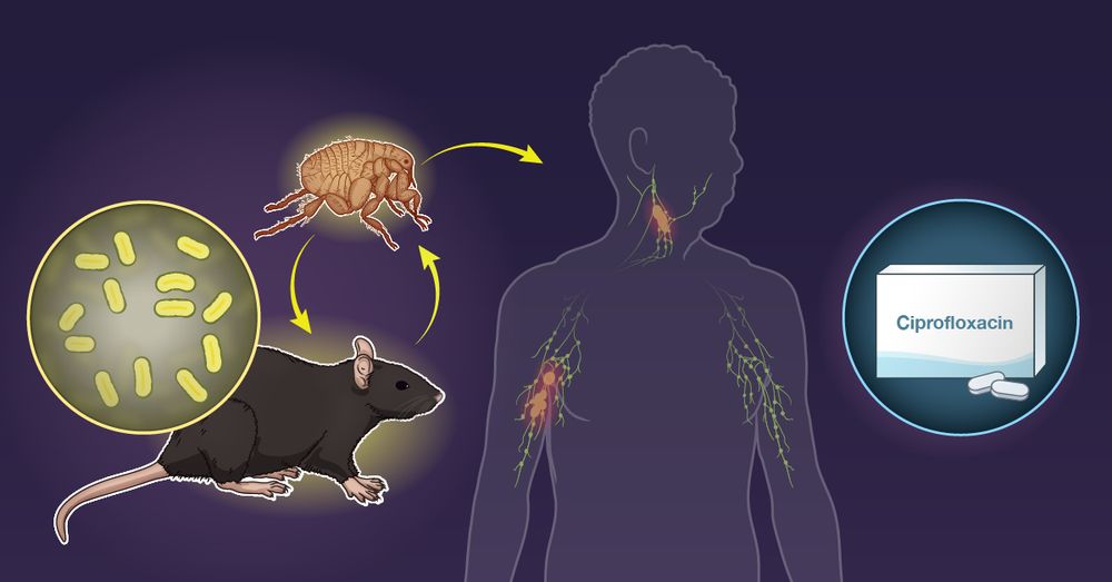 A visual representation of a patient with confirmed or probable bubonic plague and oral ciprofloxacin for possible treatment 