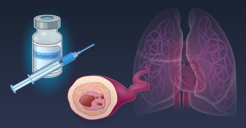 A visual representation of the HYPERION trial, which assessed the efficacy and safety of sotatercept for patients with pulmonary arterial hypertension. 