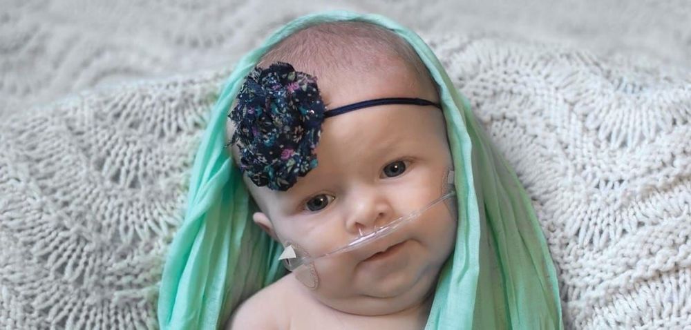 Infant resting on a white knitted blanket, draped in a mint green wrap and wearing a navy floral headband, with a nasal oxygen tube in place.