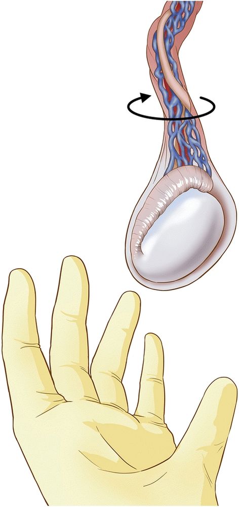 Image: medical image of a gloves hand twisting a testicle. Caption reads: how my balls be moving in tight underwear