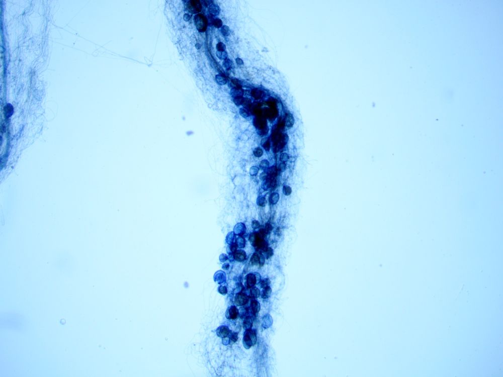 Blue stained plant root covered in darker blue circles as viewed under a microscope. Probably mycorrhizal spores.