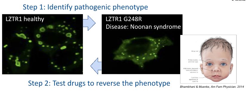 Images of cells showing protein mislocalization caused by a Noonan syndrome mutation, with the idea to screen drugs to find any that can reverse the unhealthy mislocalization
