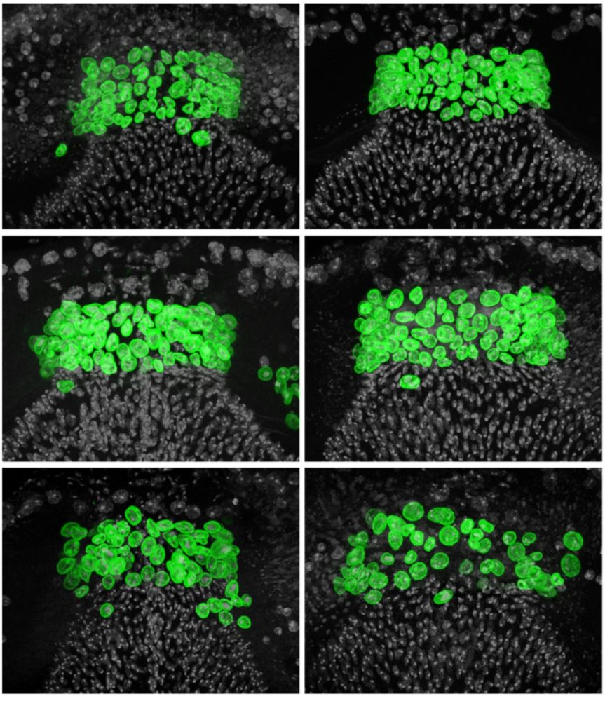 Confocal Images of the fruit fly Proventriculus 