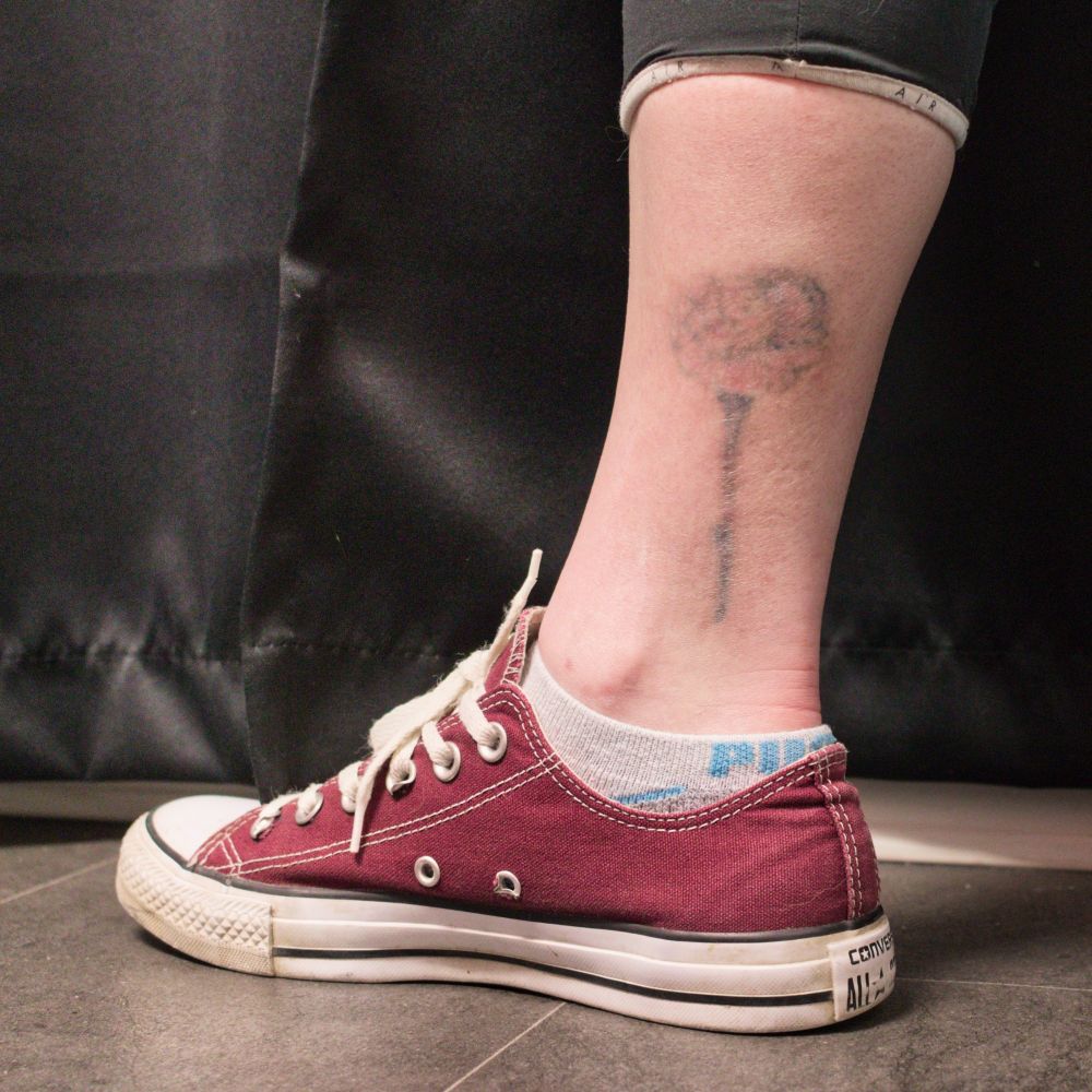 The rose tattoo after 3 laser tattoo removal treatments, 12 weeks after the 3rd treatment.