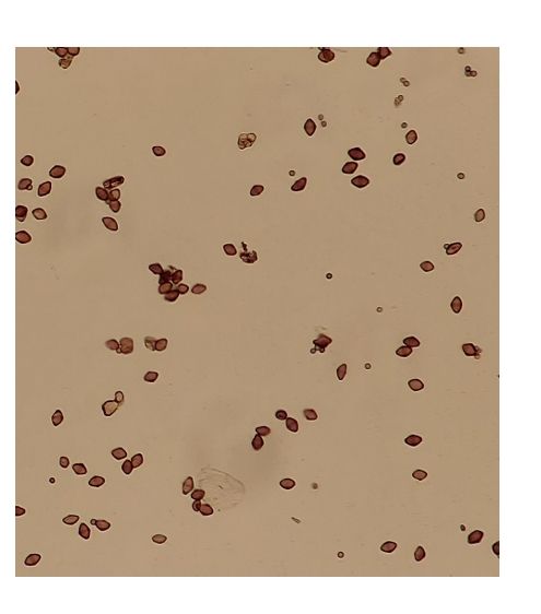 Brown, oval oocysts are the most visible lifestyle of the Helicoverpa-infecting Ophryocystis. Sorry for the lack of scale bar!