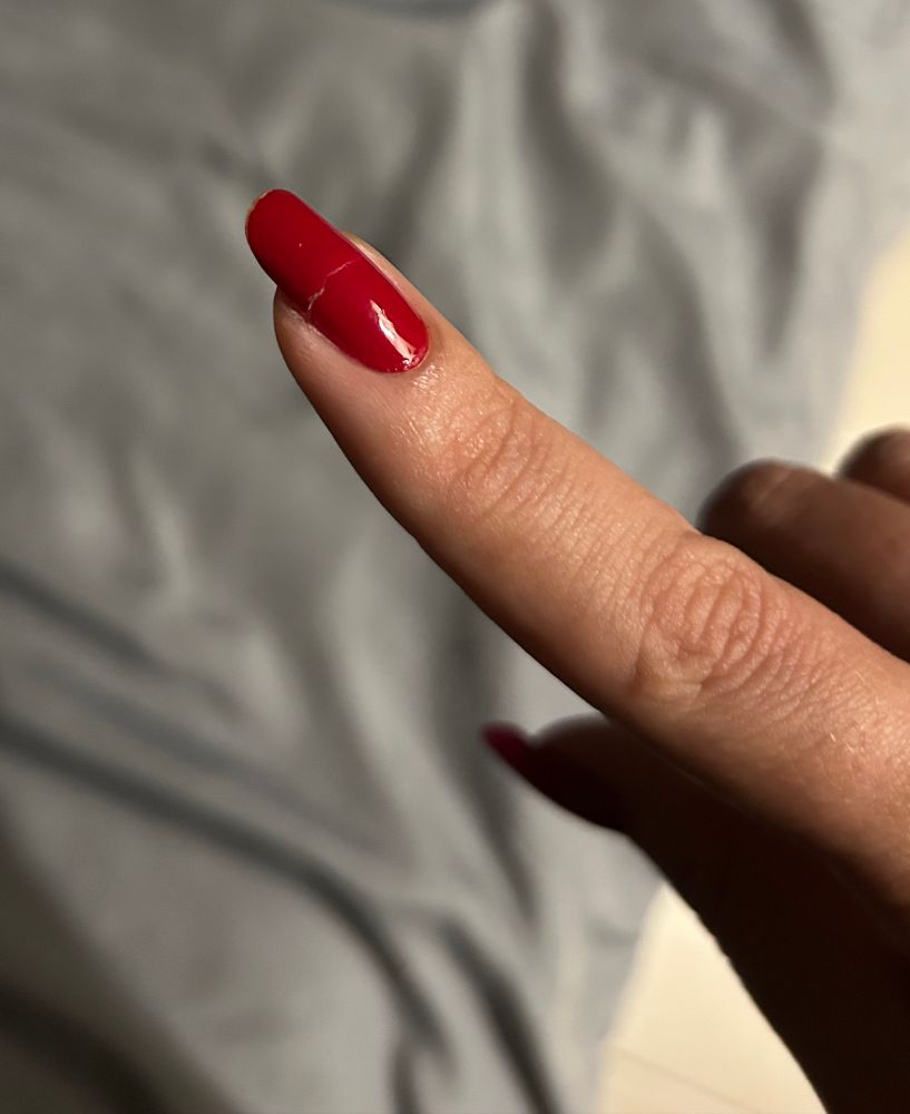 unha quebrada no talo 