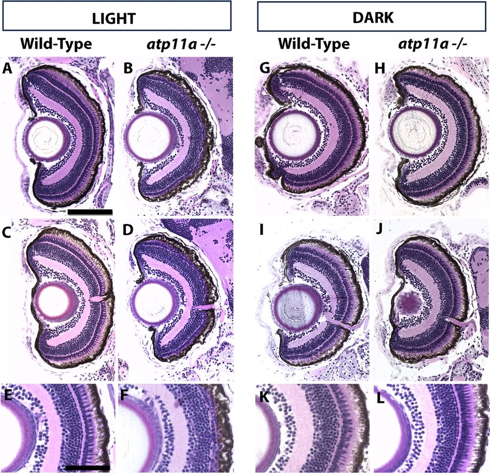 Figure showing that photoreceptor loss in atp11anl1007 mutants is partially light dependent.