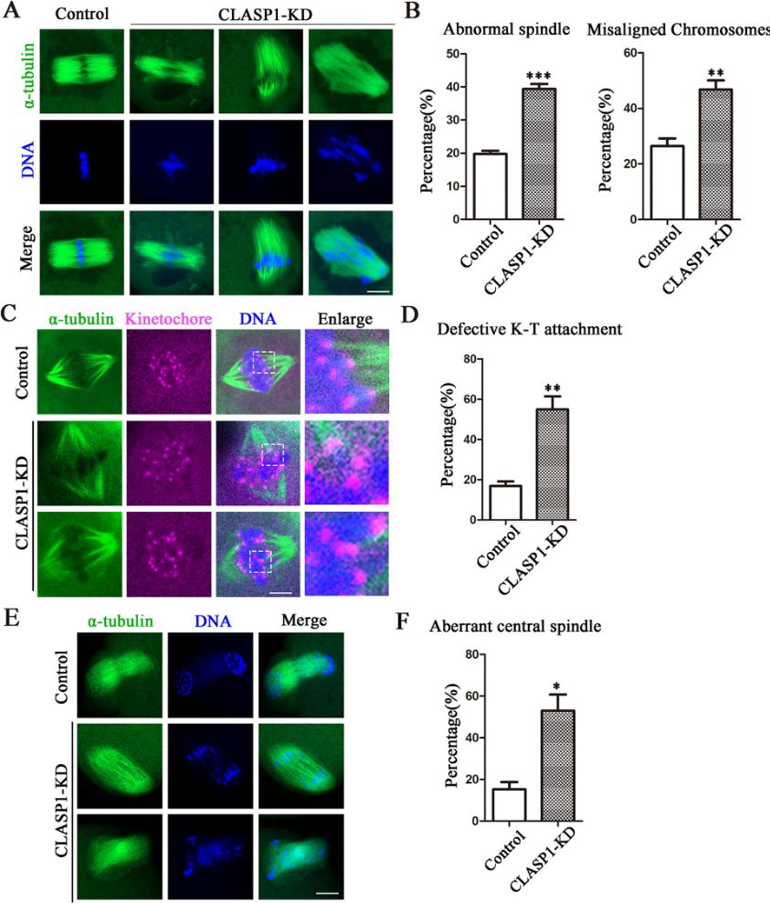 Figure showing that CLASP1 regulates spindle organization and central spindle formation in mouse oocytes.