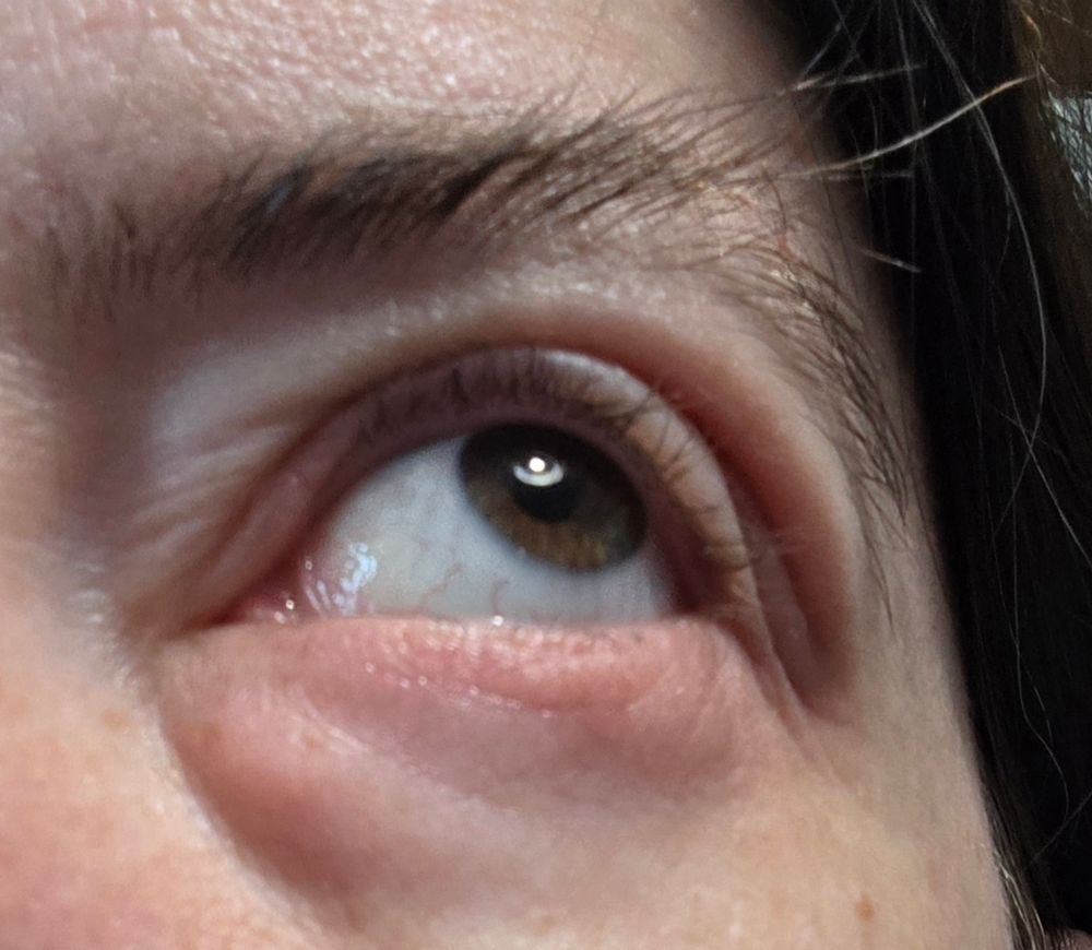 Front view, looking up and to the side
