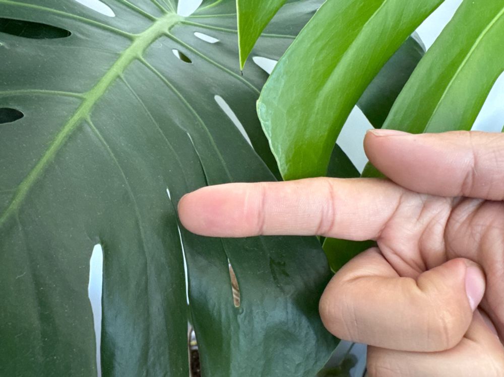 Index finger with a lateral scar