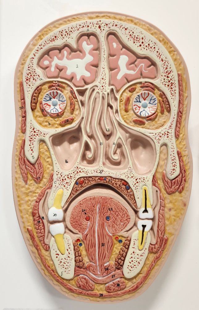 Vertical cross-section of a human face, showing bones, sinus cavities, halved eyeballs, and tongue muscle. Just standard decor for the ENT doctor's office