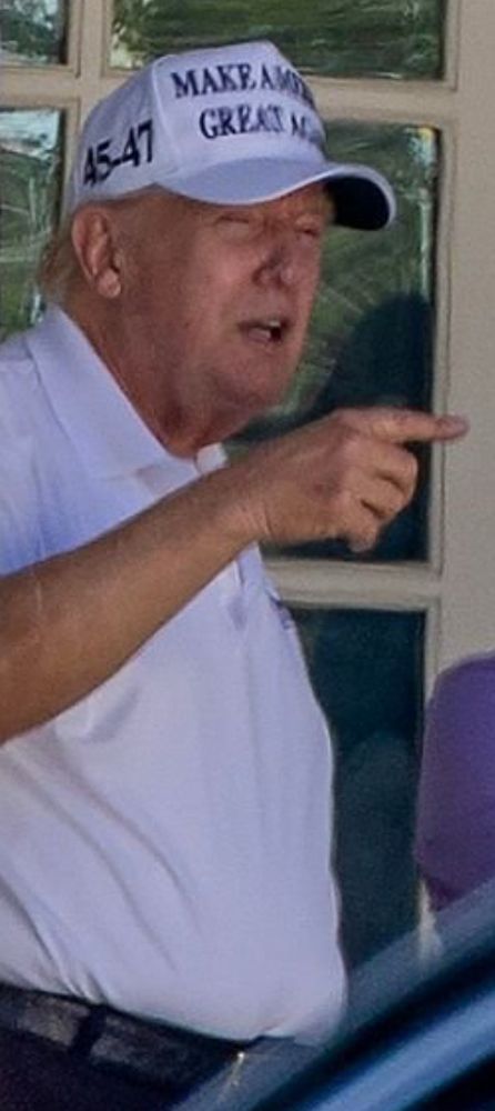 Trump pointing and showing the bruising on his right hand. 