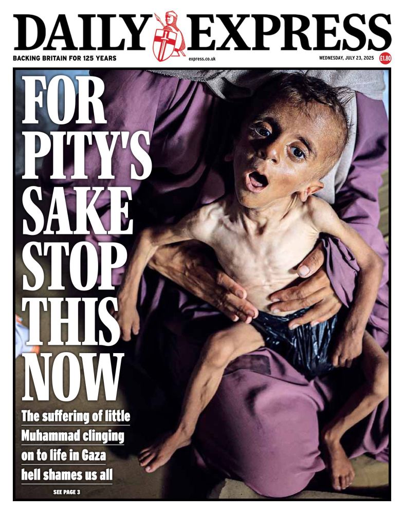 Pro-Israel right wing newspaper Daily Express front page: FOR PITYS SAKE STOP THIS NOW
The suffering of little Muhammad clinging on to life in Gaza hell shames us all