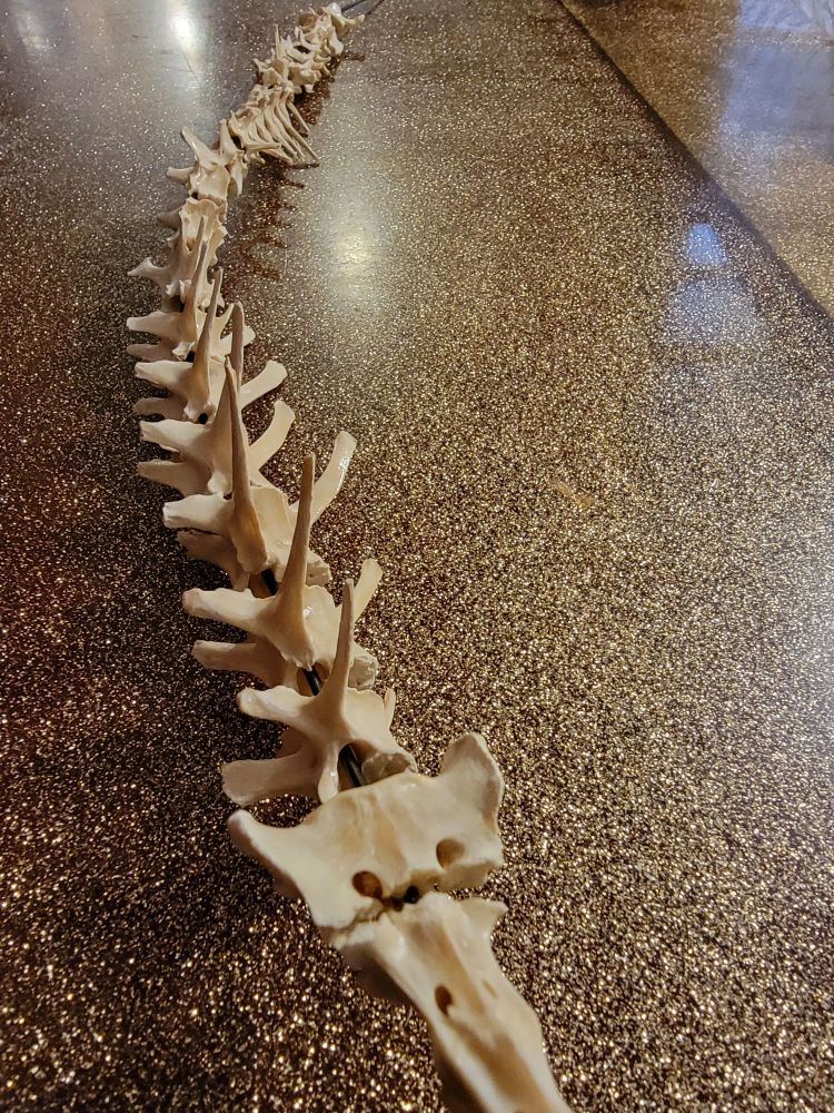 Beauregard's spine, C1 to S3