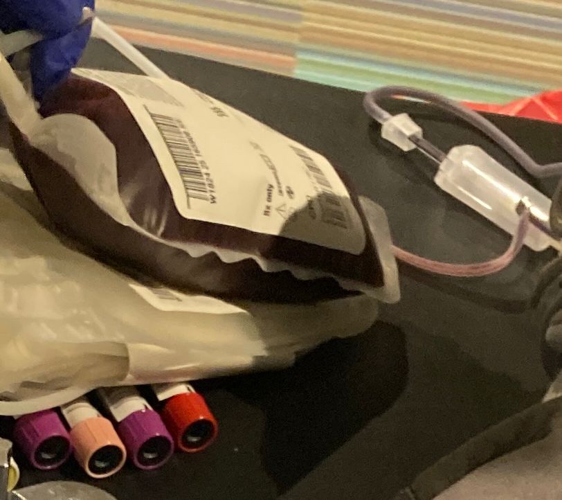 So round, so firm, so fully packed! My bagged blood, drained out of me in a little over 4 minutes. I hydrated well all day. 