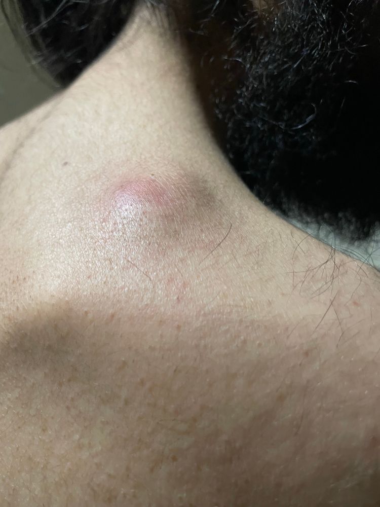 anemia, pain in his shoulders and he has lump in his shoulder as well and he his pain in his stomach and always dizzy and nausea and he has hemorrhoid as well. I beg you support us . We are hungry, chronically ill and we can’t afford to eat or buy meds , hygiene and pay our bills without your support