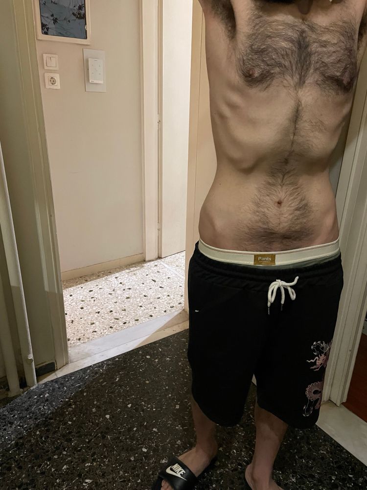 I have mental health and other health issues my disabled brother lives with me he has a lot of health issues he is suffering from malnutrition, anemia, asthma, Constipation , hemorrhoid and he is scary skinny. Soon they will cut the electricity if we don’t pay it so we will end in the street because I work from home so I need electricity if I don’t have electricity I will lose my job unfortunately my salary is not enough at all I can barely afford to pay my rent I can’t afford food , hygiene , bills , medicine . I beg you support us my disabled brother will not survive in the street for 2 minutes your support can save our life and avoid sleeping in the street we are sick and hungry and we need your support 🙏🏻😔