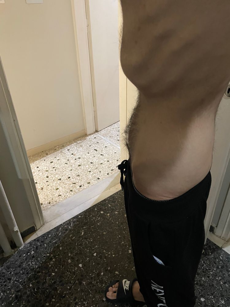 I have mental health and other health issues my disabled brother lives with me he has a lot of health issues he is suffering from malnutrition, anemia, asthma, Constipation , hemorrhoid and he is scary skinny. Soon they will cut the electricity if we don’t pay it so we will end in the street because I work from home so I need electricity if I don’t have electricity I will lose my job unfortunately my salary is not enough at all I can barely afford to pay my rent I can’t afford food , hygiene , bills , medicine . I beg you support us my disabled brother will not survive in the street for 2 minutes your support can save our life and avoid sleeping in the street we are sick and hungry and we need your support 🙏🏻😔