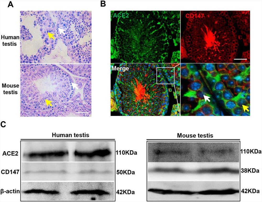 CD147 mediates S protein pseudovirus of SARS-CoV-2 infection and its induction of spermatogonia apoptosis