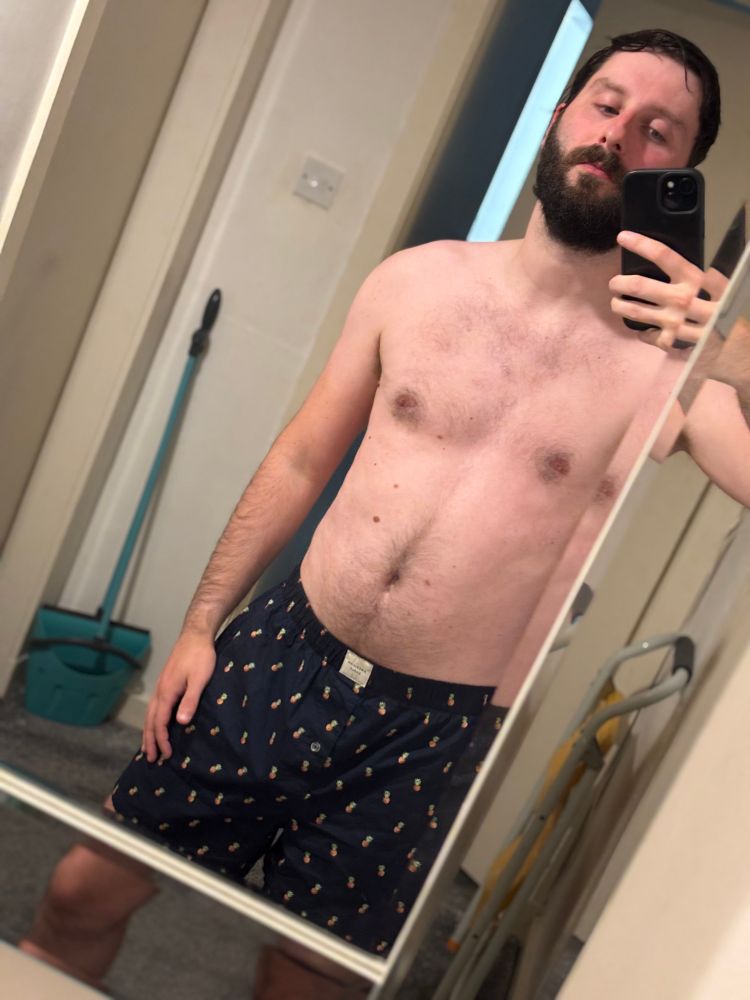 Post bath mirror shot, in my hallway, with no top on. My navy shorts have small pineapples on them