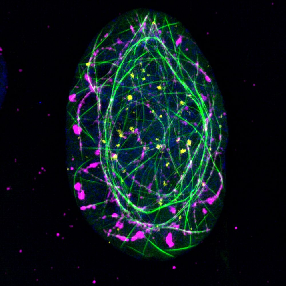 A cell nucleus with an extensive f-actin network decorated by telomeres and PML foci 