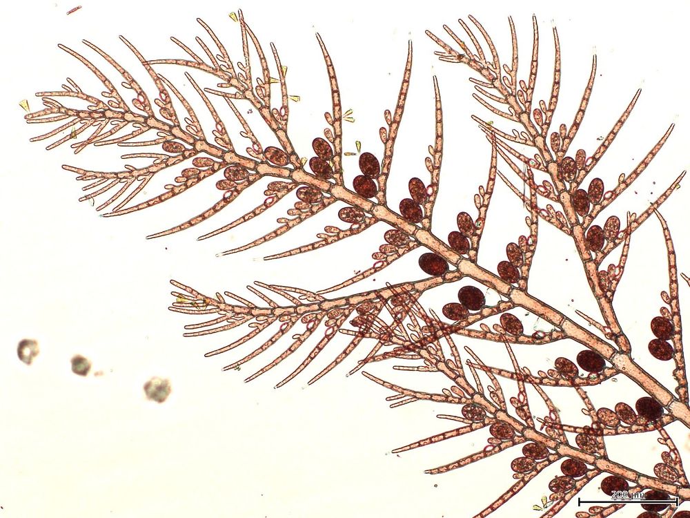 A microscopic view of a filamentous red alga called Antithamnionella spirographidis. The alga is a filament made of cylindrical cells, with a herringbone-like branching pattern and large, round and dark sporangia at the base of each branch 
