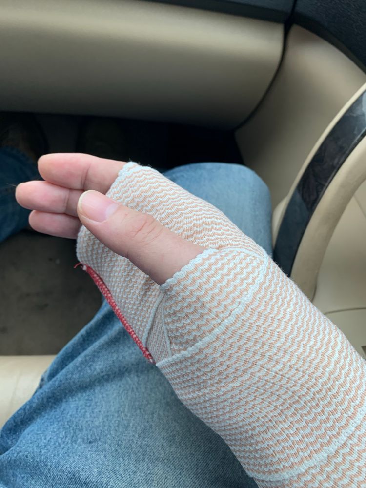 My right hand, wrapped in a splint and bandage.