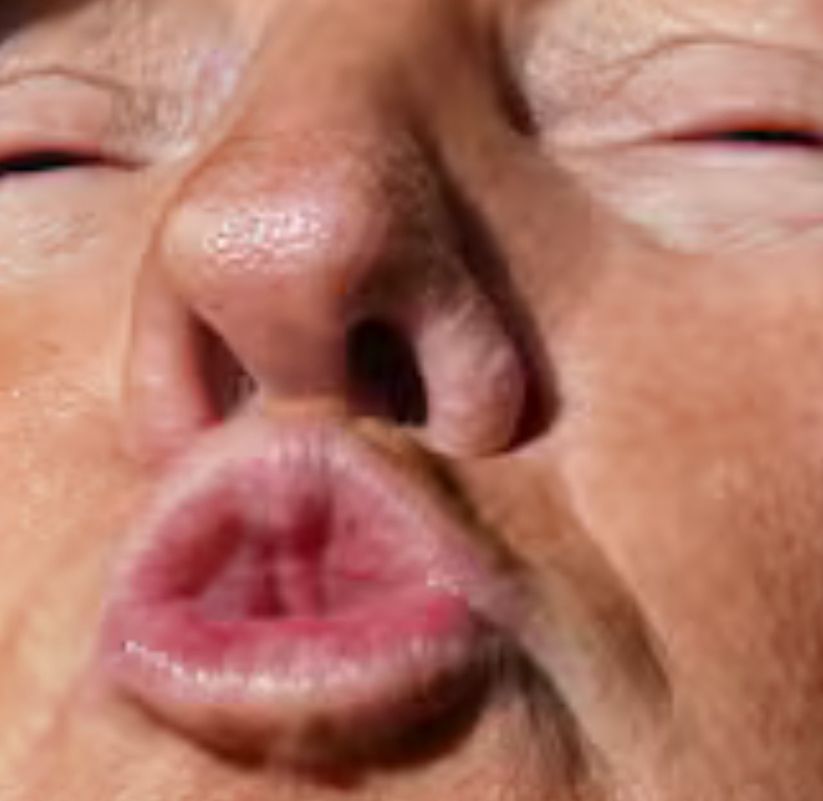 A closeup of trump’s weird little butthole mouth