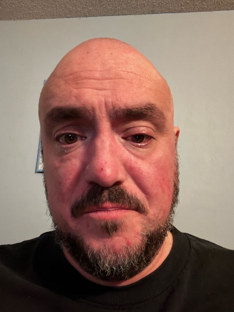 Photo evidence of how ugly I am.