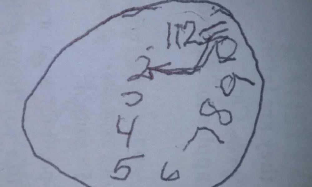 A clock drawn for that cognition test. The circle is not a circle, the numbers run backwards, and the clock appears to have three hands instead of two.