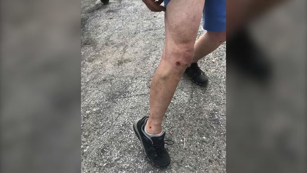 Injuries sustain on the mans leg, scraps and scratches from being attack by US forces