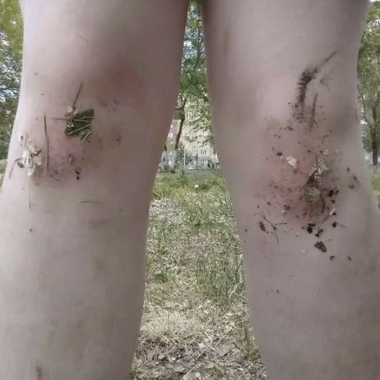 knees covered in grass and dirt