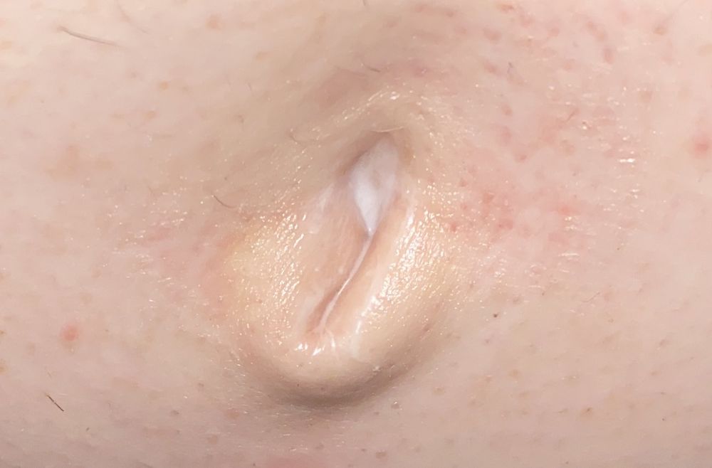 innie outie belly button with lotion