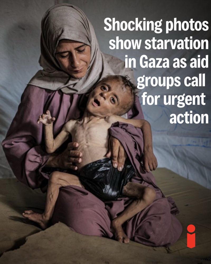 A Child starvating to Death in Gaza as aid groups call for urgent action.
