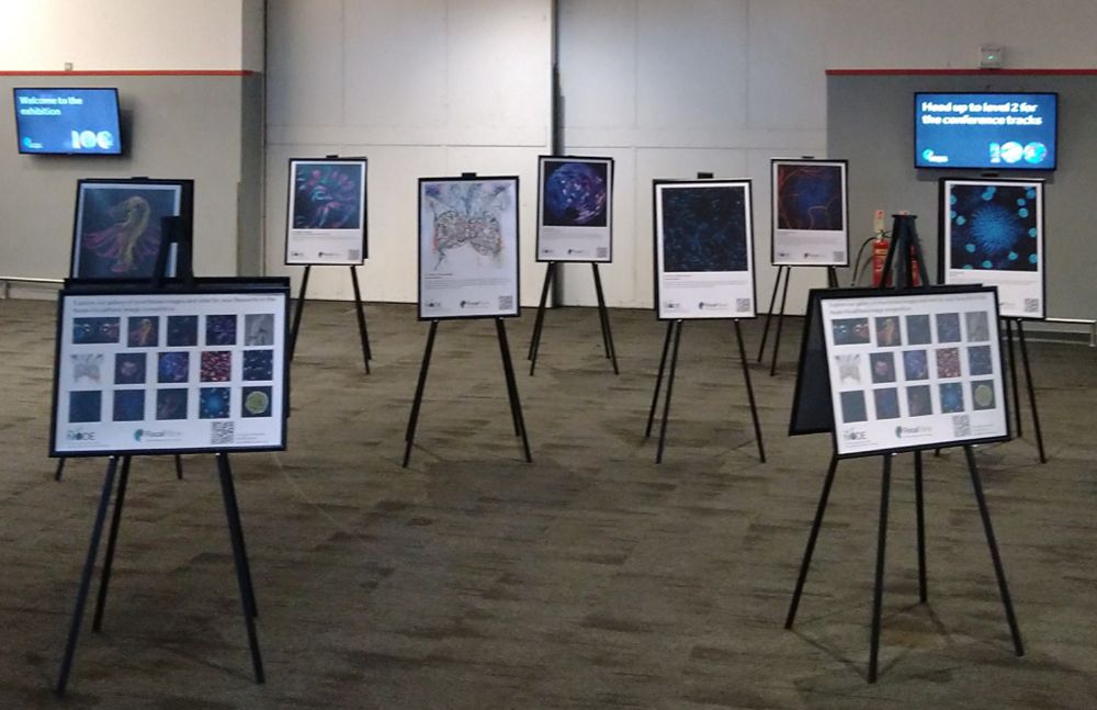  Picture of easels displaying microscopy images.