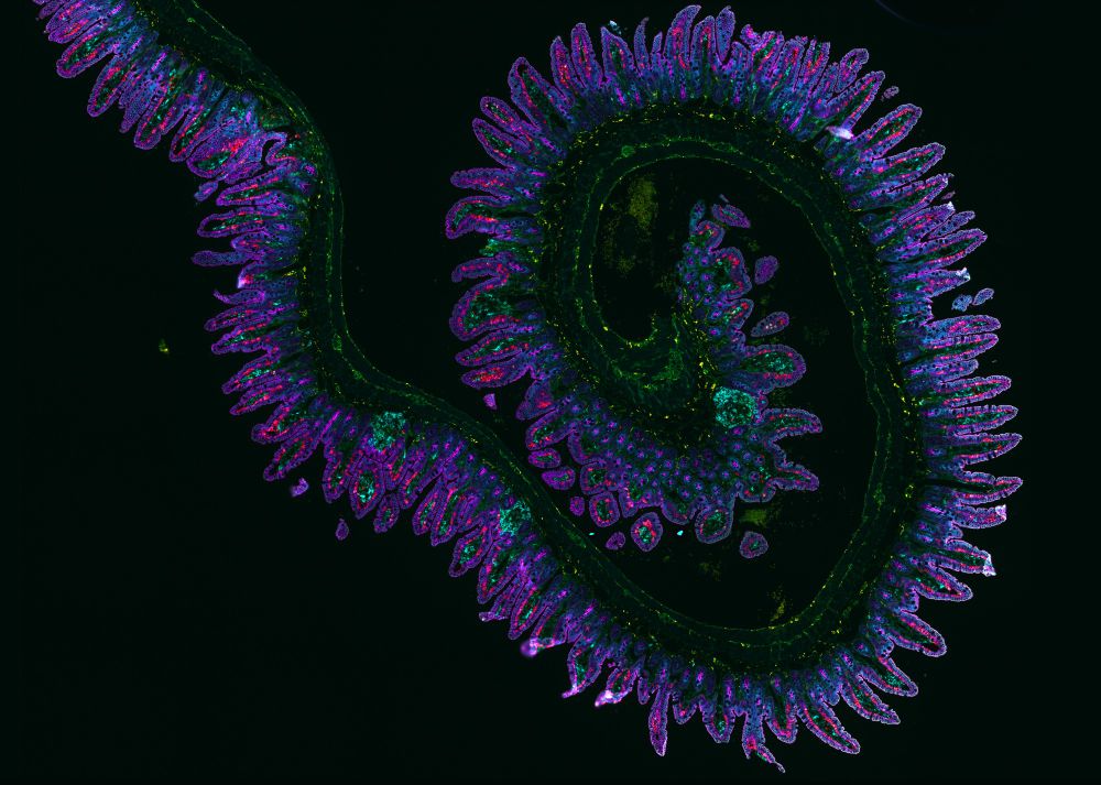 Orion 15 channel imaging of a normal murine ileum spiral. Courtesy of Simon Goldstein, La Jolla Institute for Immunology. The image shows the wavy lining of the ileum, with finger-like villa reaching out. Cells are highlighted with green, purple, pink, and blue florescent markers.