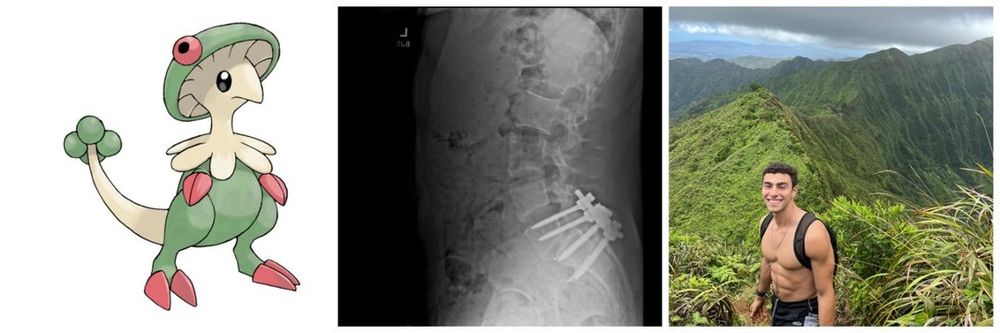 Luigi Mangione's Twitter banner depicting the Pokémon Breloom, an X-ray of a spine injury, and a shirtless smiling young man on a grassy mountain