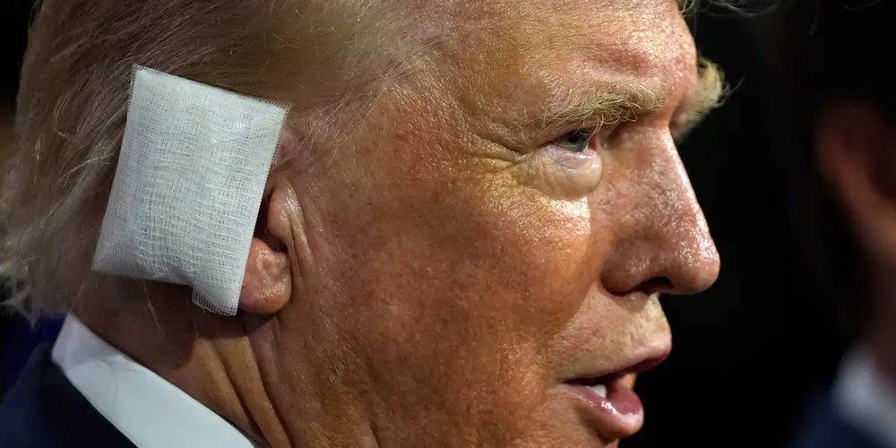 Trump with ear bandage