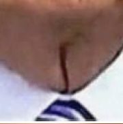 Trump's neck