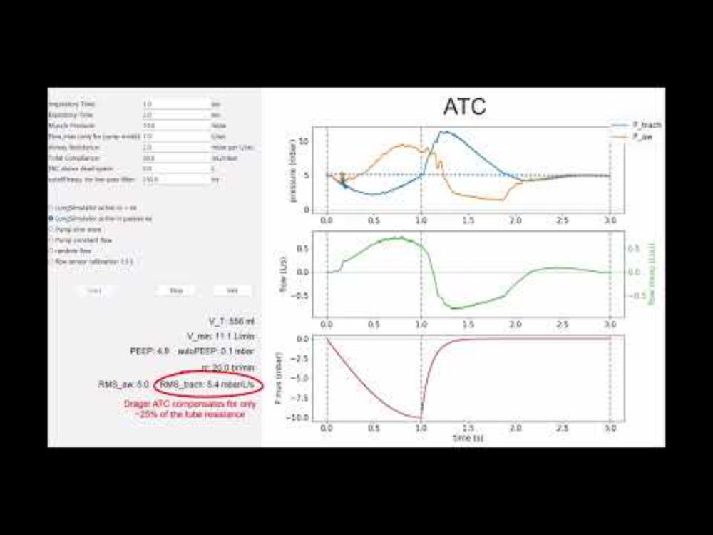 Dräger Evita V600 in CPAP and ATC mode
