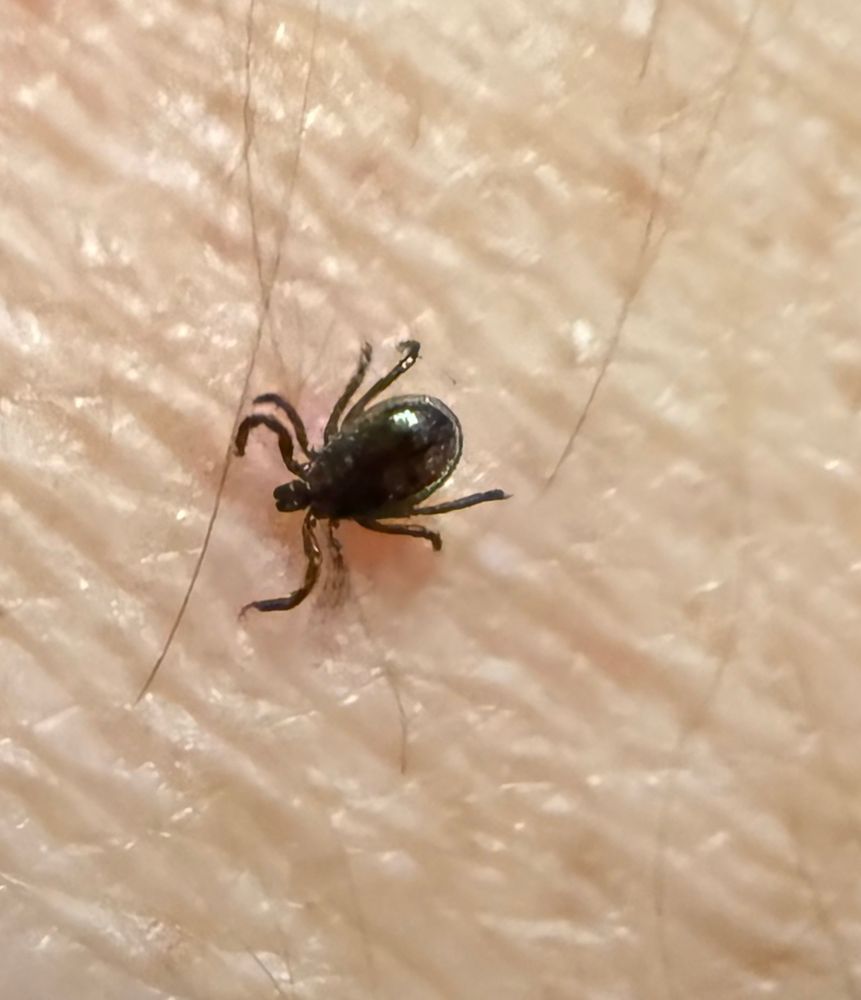 Schwarze Zecke auf nackter Haut