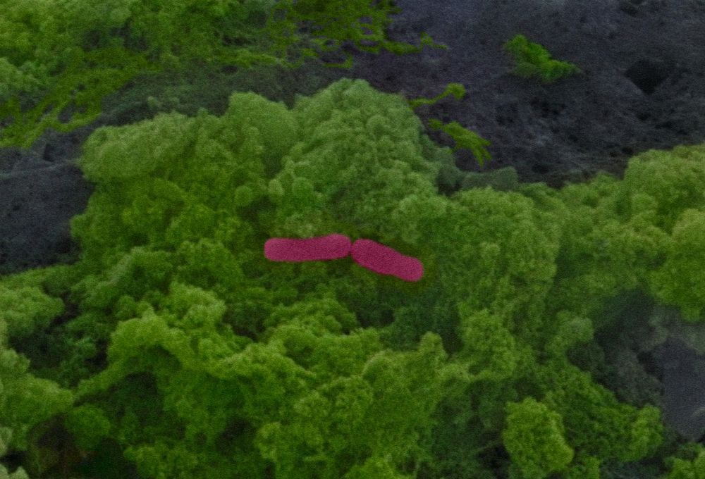 Microscopy image showing microbial cells (stained in pink) in the gut of a mouse. (Credit: Justin Sonnenburg/Stanford University)